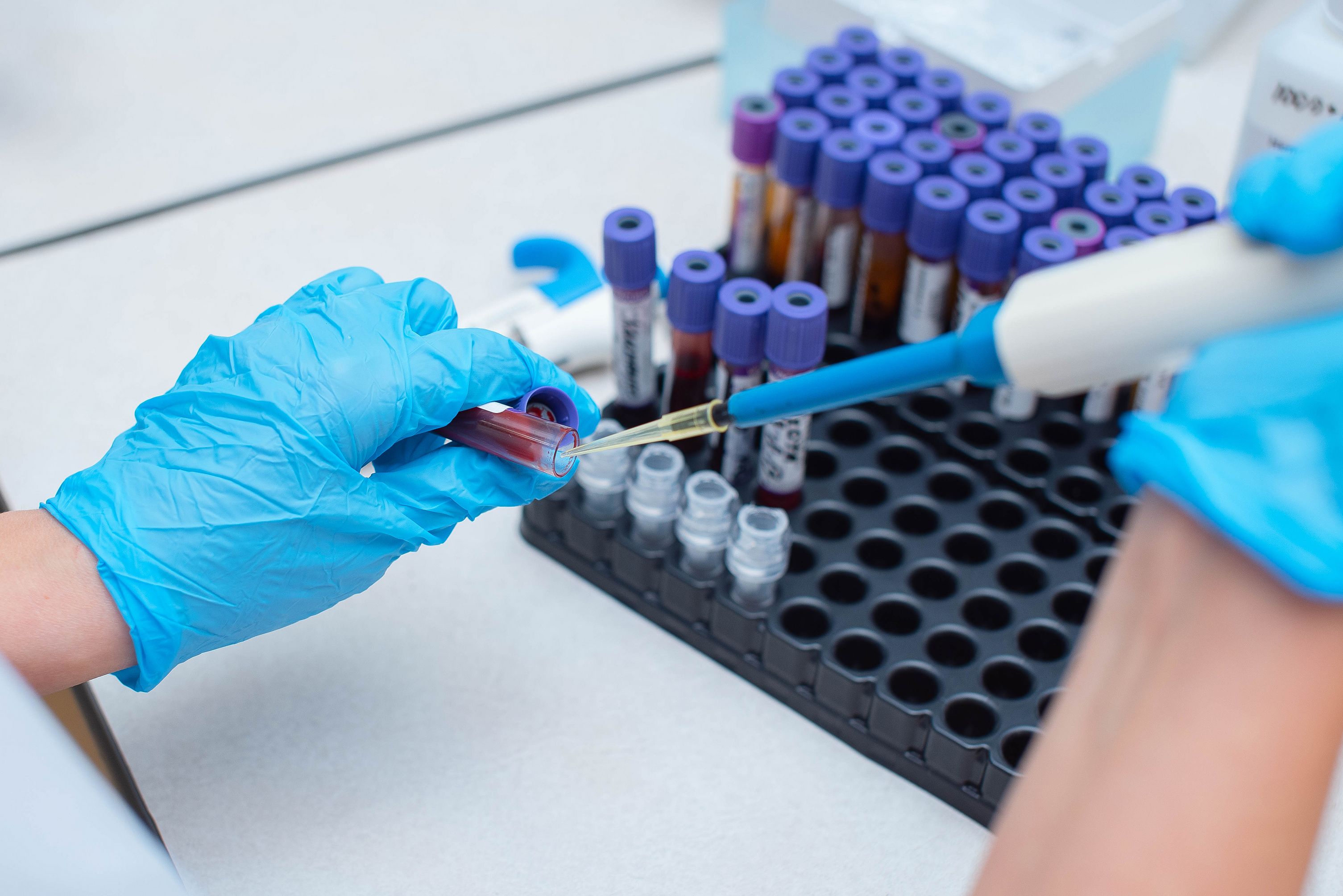 exame-de-sangue-em-laboratorio.jpg